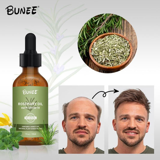 BUNEE Rosemary Hair Growth Serum Oil